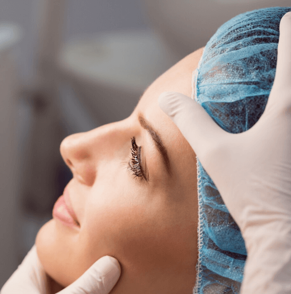 Rinoplastia - Dr. Carlos Rodríguez